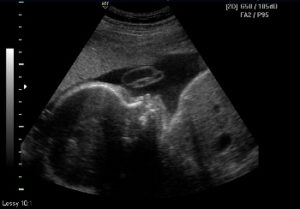 3D & 4D Sonography