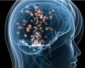 Brain Image